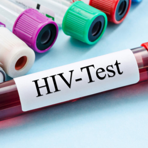 O nouă speranță în tratamentul HIV: tehnologia ARNm promite eliminarea virusului